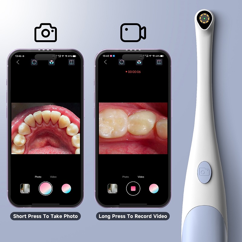 Oral Endoscope Camera 1440P Ph - Photography Lighting Diagram ulasan dan harga