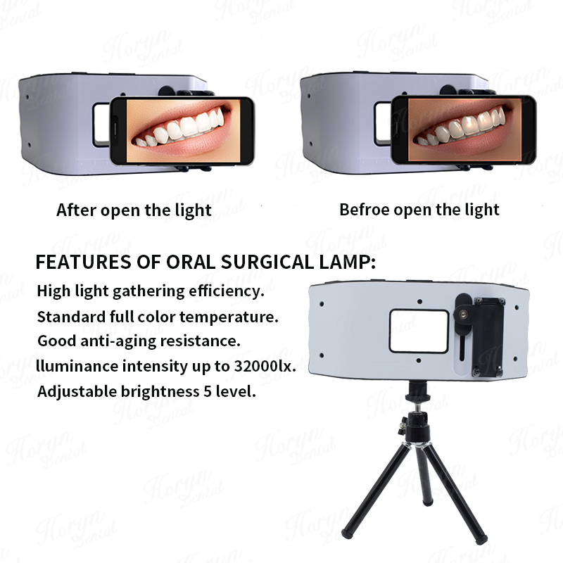 Dental Flash Light Photography - Photography Lighting Led ulasan dan harga